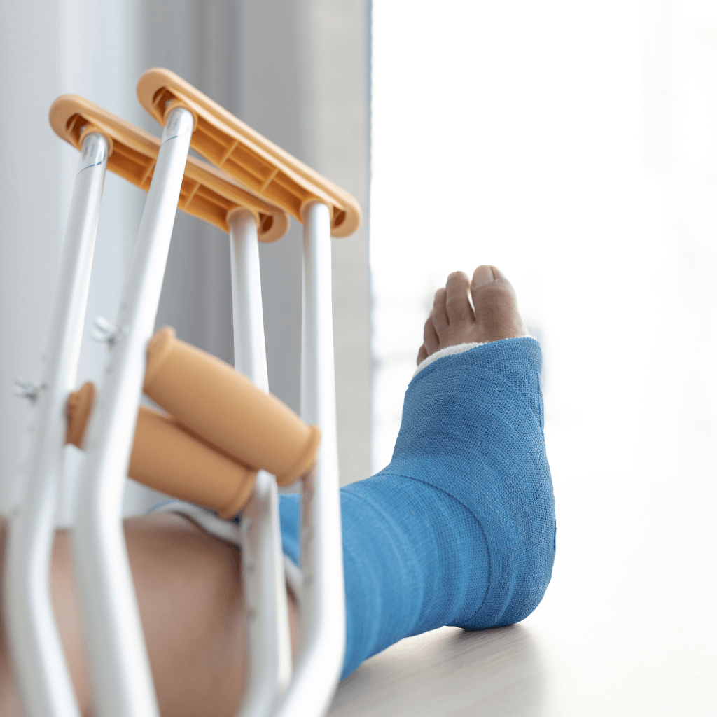 crutches and a person's foot in a cast